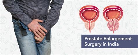 Prostate Enlargement Surgery Cost in India, Rezum Therapy Cost in India