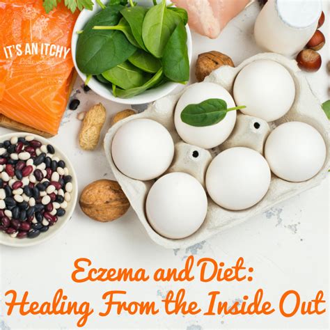 Eczema and Diet: Healing From the Inside Out