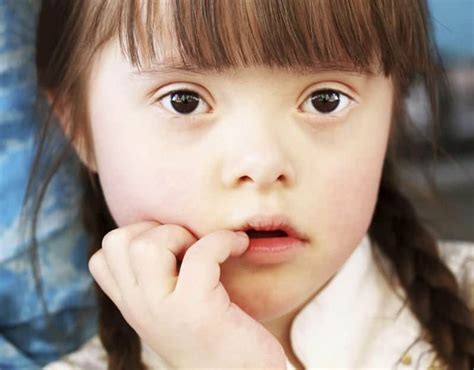Myths and truths about the people with Down syndrome