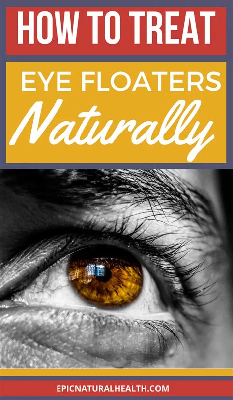 How to Naturally Treat Eye Floaters & Flashes at Home - Epic Natural Health