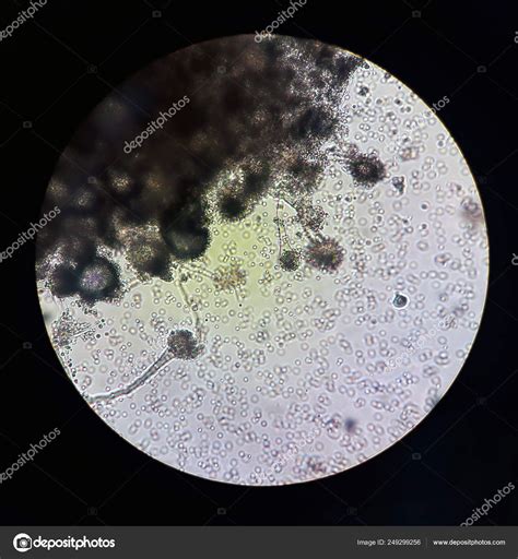 Aspergillus Under Microscope