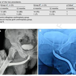 Follow-up protocol. UFM, uroflowmetry; RGU, retrograde urethrogram ...