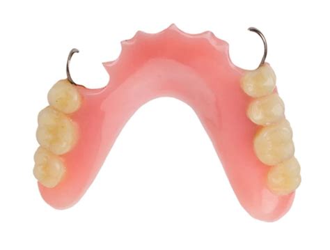 Partial Acrylic Dentures - Twinkle Family Dentalcare