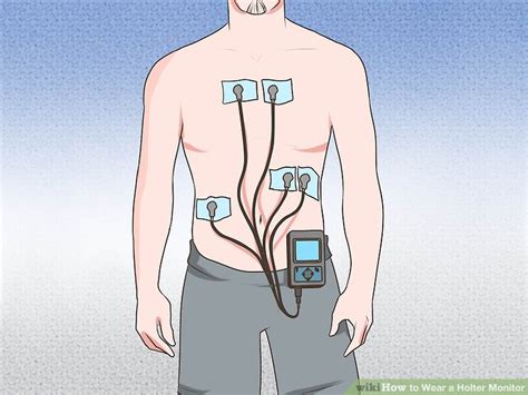 Holter Monitor 5 Lead Placement Diagram - Wiring Diagram