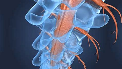 Spinal Cord Tumors | Johns Hopkins Medicine