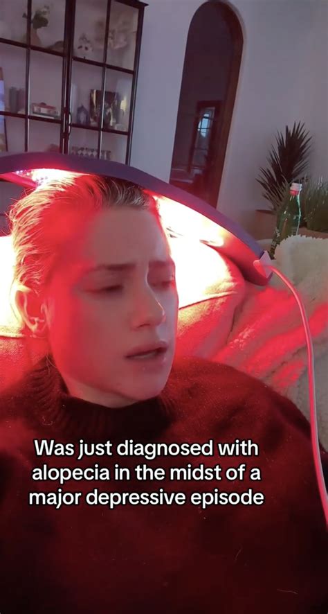 Lili Reinhart reveals alopecia diagnosis after suffering from ‘major ...