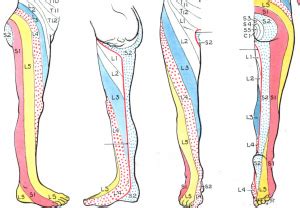 What is S1 Radiculopathy? ⋆ Santa Barbara Deep Tissue - Riktr PRO ...