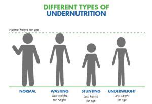 Malnutrition, Its Causes and Types of Malnutrition - Public Health Notes