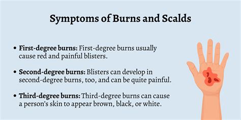 First Aid for Burns and Scalds - First Aid for Free