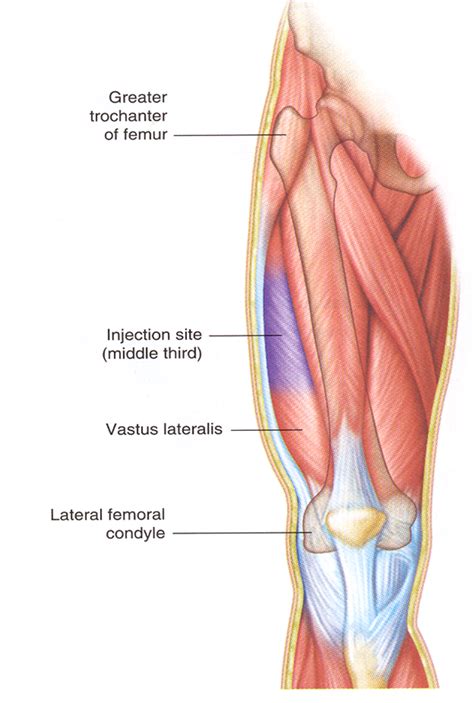 vastus lateralis intramuscular injection site | Nursing school tips ...