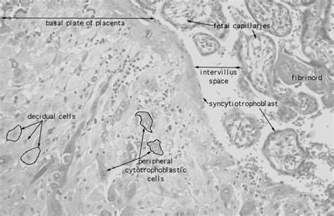 HLS [ Female Reproductive System, placenta, decidual cells] HIGH MAG labeled