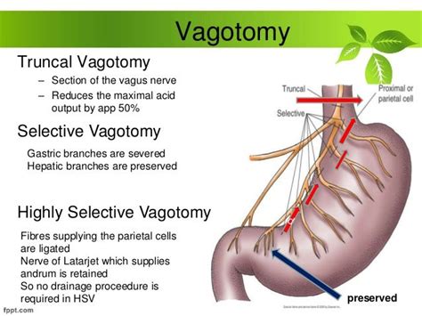 Peptic ulcer