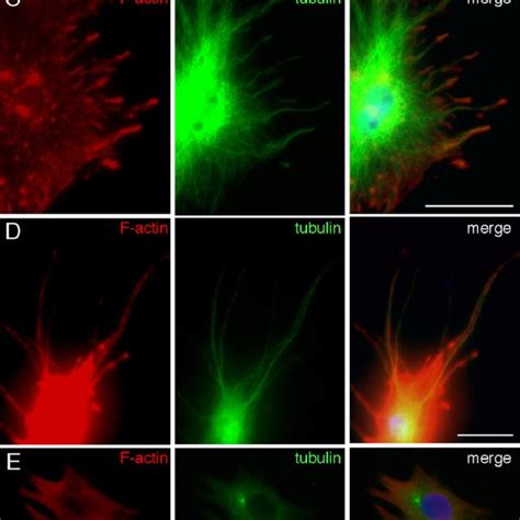 Lamellipodia formation on monomeric collagen I and spike formation on... | Download Scientific ...