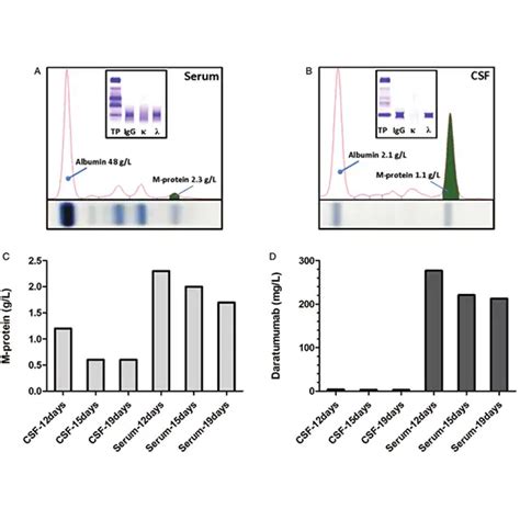 Protein Electrophoresis, CSF Test in Delhi NCR, India | GDIC