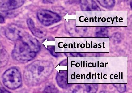 Follicular dendritic cells - Wikipedia