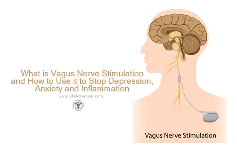 What Is Vagus Nerve Stimulation and How to Use It to Stop Depression, Anxiety and Inflammation