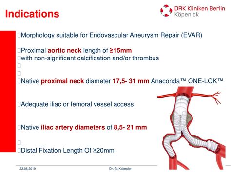 PPT - Anaconda™ Stentgraft System Overview PowerPoint Presentation, free download - ID:9224393