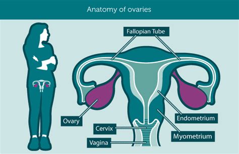 ovarian cancer Archives - Jeffrey Sterling, MD