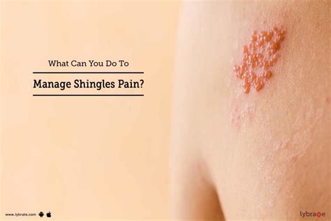 What Can You Do To Manage Shingles Pain? - By Dr. Purvi C Shah | Lybrate