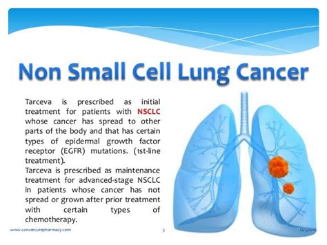 Cure For Non Small Cell Lung Cancer - CancerWalls