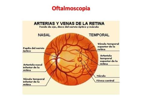 Oftalmoscopia