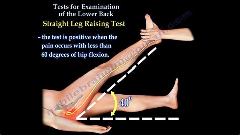 Straight Leg Raise Test