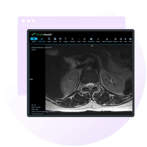 PACS Software System| Explore Medical Imaging Capabilities