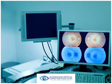 Optos Retinal Imaging: What You Need to Know