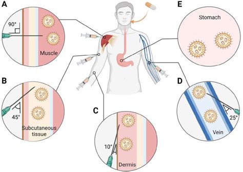 Main systemic delivery routes of RNA-LNPs. The selection of an ...