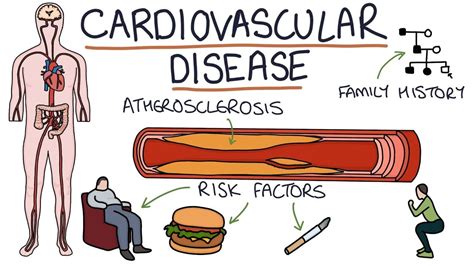 Cardiovascular Disease - Symptoms, Causes,types & Risk Factors