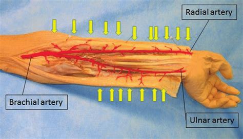 Radial Artery Location