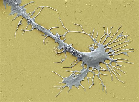 Stem Cell-derived Neuron Growth Cone Photograph by Thomas Deerinck, Ncmir/science Photo Library