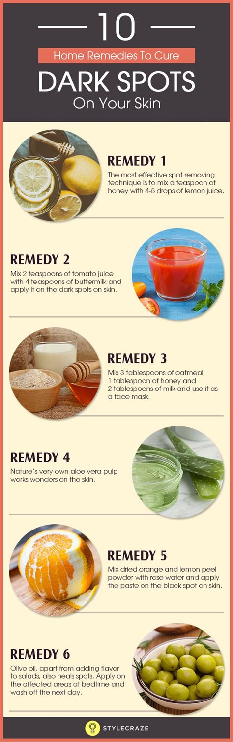 10 Natural Remedies For Curing Dark Spots On Your Skin Infographic