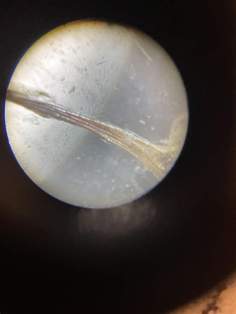 Hornet stinger on a microscope : r/Damnthatsinteresting