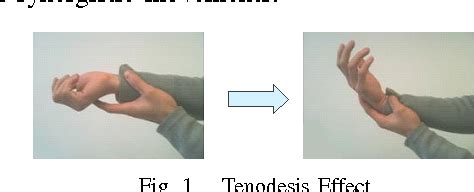 Figure 1 from Arm-hand movement: Imitation of human natural gestures with tenodesis effect ...