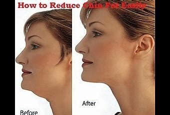 5 Tips to Lose Fat Chin - Discover How to Reduce Chin Fat Easily - Paperblog