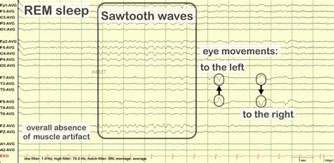 rapid eye movement (REM) sleep