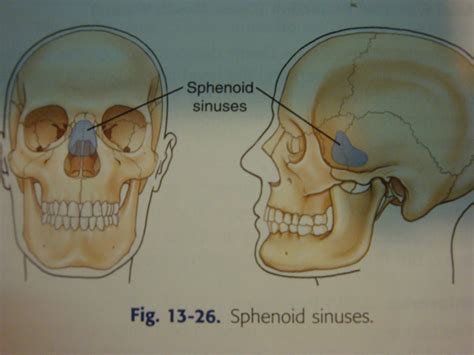 Sphenoid Sinus contamination photographs - EmmyhtyuiMontague