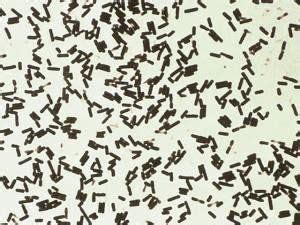 Clostridium Perfringens | Texas West Animal Health