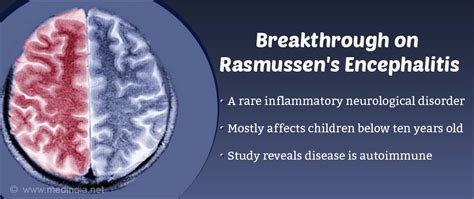 Rasmussen's Encephalitis Recently Proved to be An Autoimmune Disease