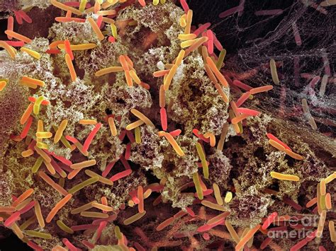 Pseudomonas Aeruginosa Bacteria #2 Photograph by Science Photo Library - Fine Art America