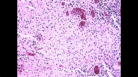 Salmonella Enterica Microscope - Mijacob