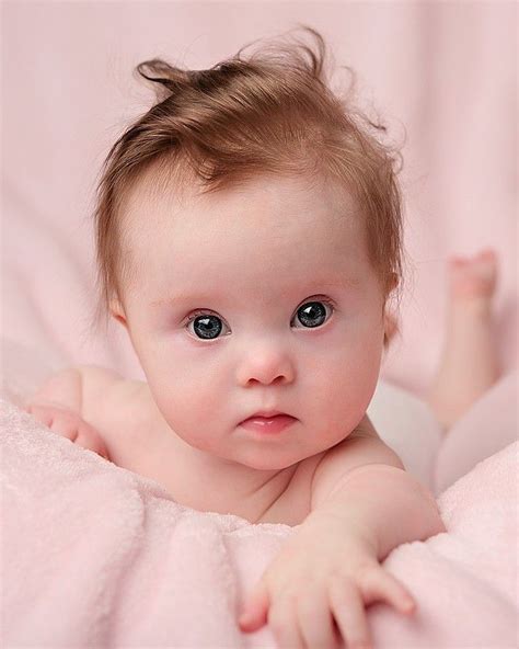 Beautiful Little Girl with Down Syndrome | Beautiful children, Down ...