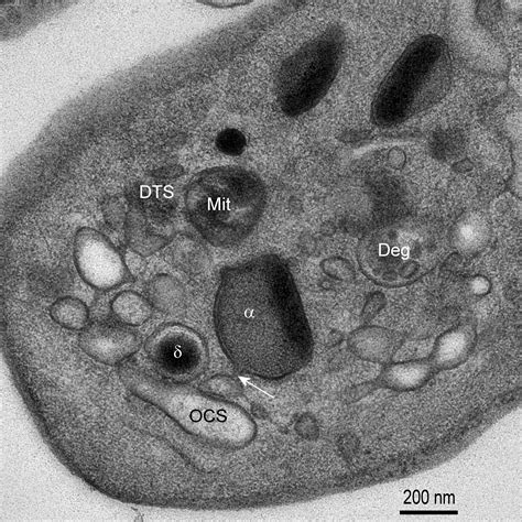 Transmission Electron Microscopy of Platelets FROM Apheresis and Buffy-Coat-Derived Platelet ...