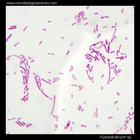 Fusobacterium. Gram stain and cell morphology. Fusobacterium micrograph ...