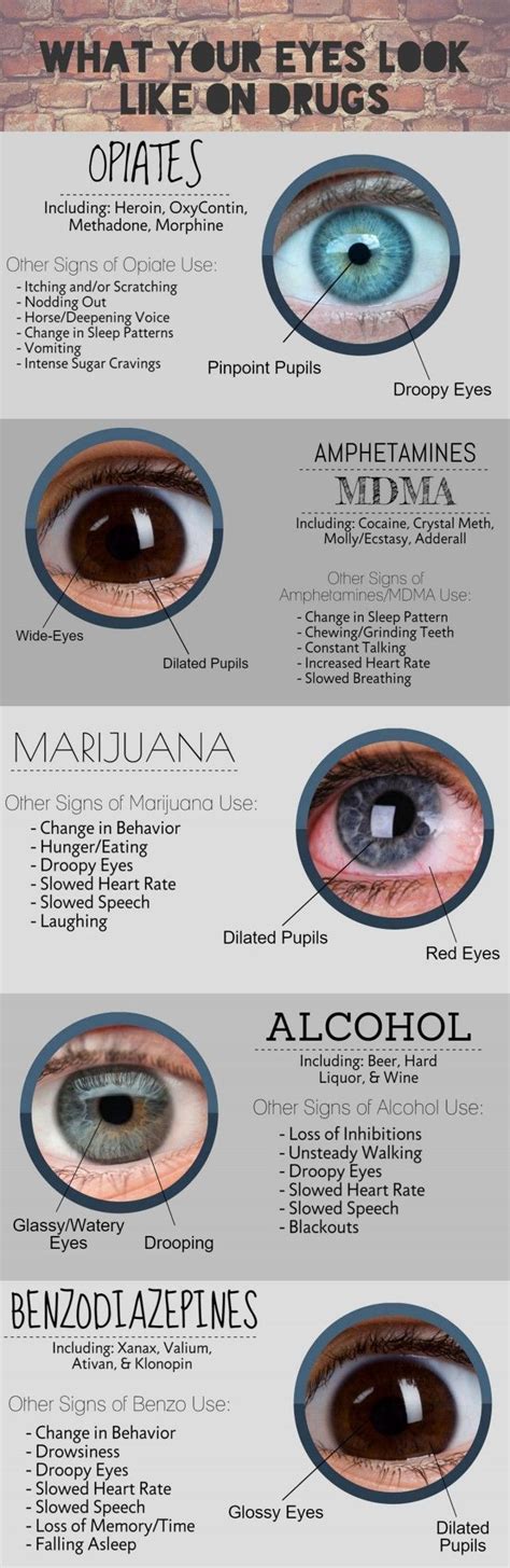 whats your eyes look like on drugs, study it. Doctors will faster identify what you have been on ...