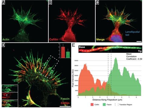 Identification of cofilin-rich regions at the base of neuronal growth... | Download Scientific ...