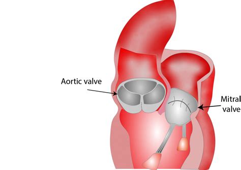 Aortic valve anatomy - Critical Care Sonography