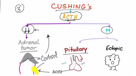 test for cushing's disease Cushing tests cushings criteria ...