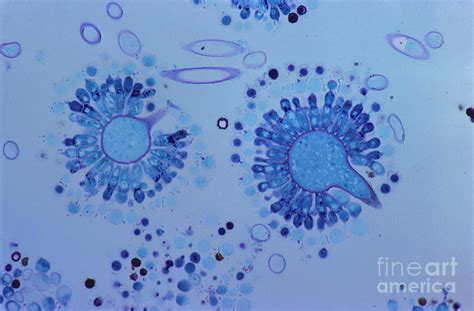 Aspergillus Spores Lm Photograph by M. I. Walker - Pixels